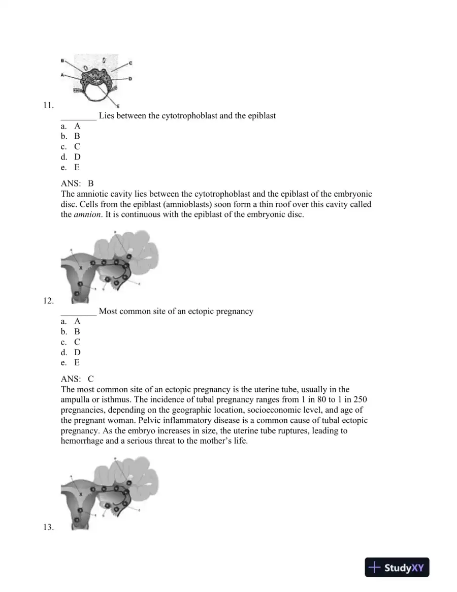 The Developing Human: Clinically Oriented Embryology, 9th Edition Test Bank, page 16