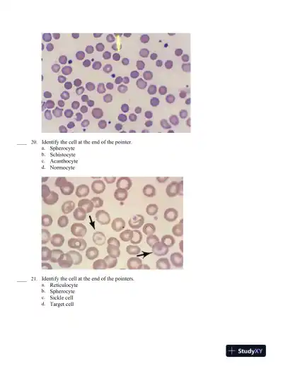 Hematology in Practice 2nd Edition Test Bank - Page 14 preview image