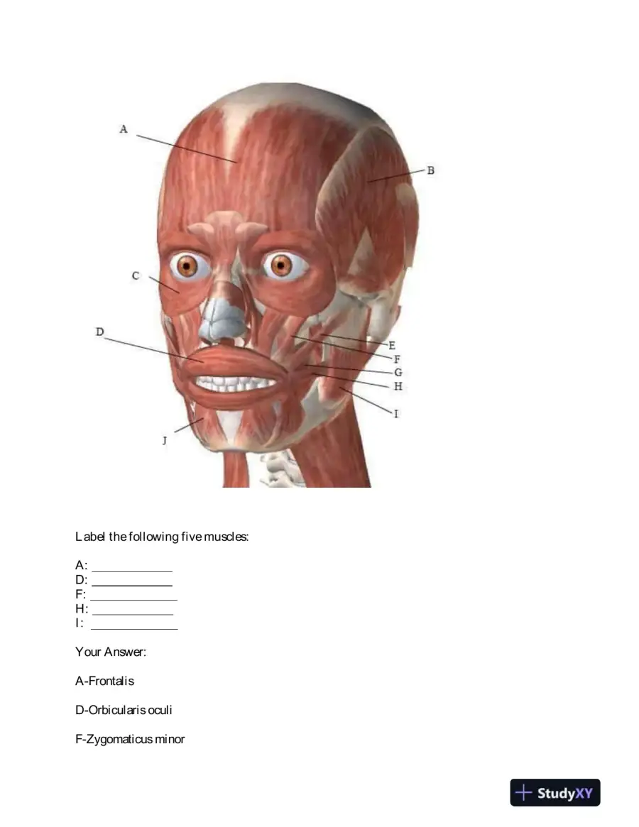 BIOD151 Portage Learning Anatomy and Physiology Module 5 Exam With Answers (26 Solved Questions), page 5