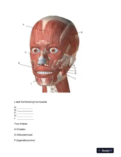 BIOD151 Portage Learning Anatomy and Physiology Module 5 Exam With Answers (26 Solved Questions) - Page 5 preview image