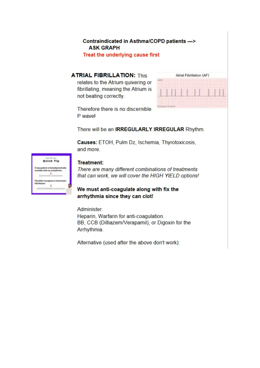 Understanding EKG Rhythms and Pacemaker Care NCLEX, page 4