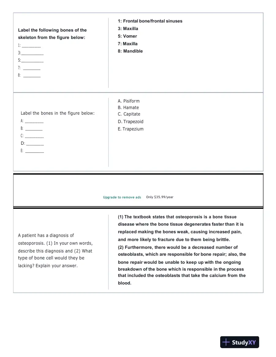 Portage Learning Anatomy and Physiology Final Exam With Answers (142 Solved Questions), page 5