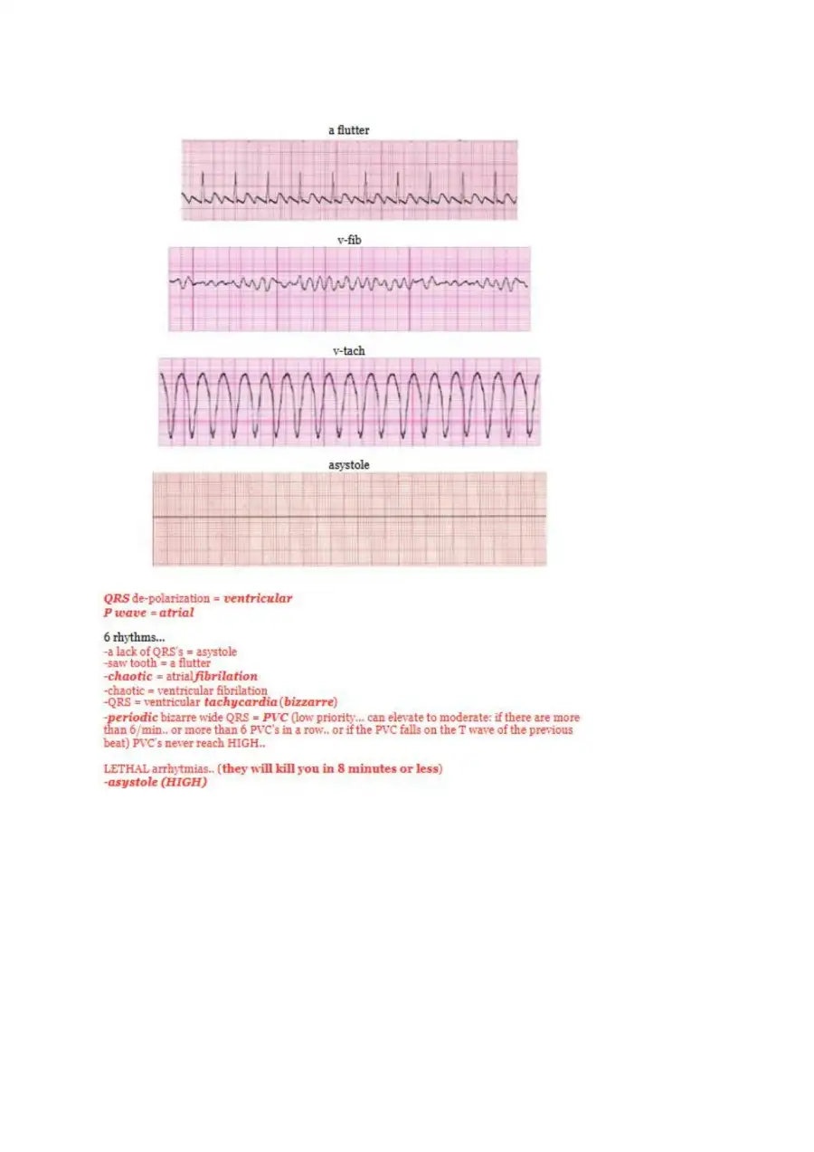NCLEX Acid Base Balance Ventilators, page 9