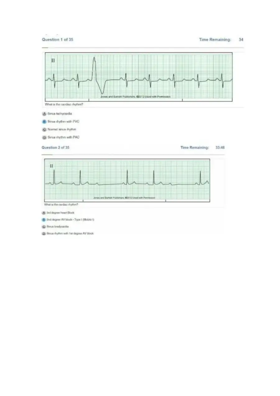 Relias DYSRHYTHMIA BASIC A Exam, page 2