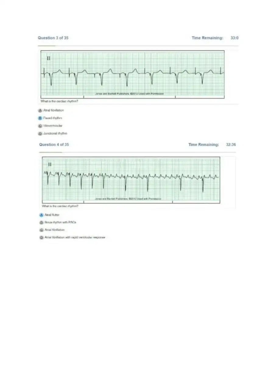 Relias DYSRHYTHMIA BASIC A Exam, page 3