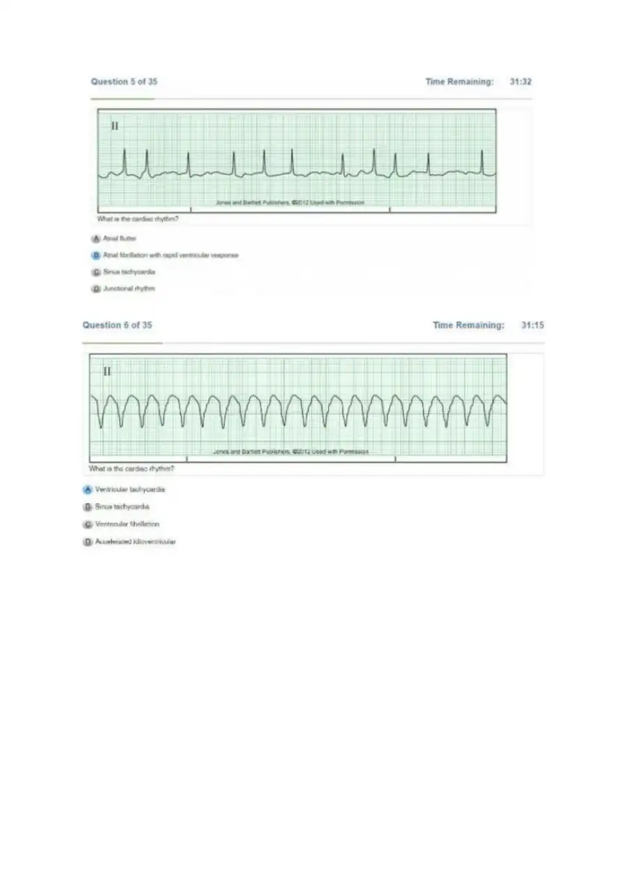 Relias DYSRHYTHMIA BASIC A Exam, page 4