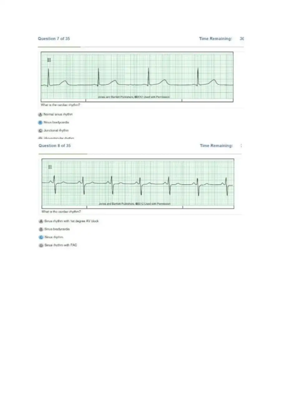 Relias DYSRHYTHMIA BASIC A Exam, page 5