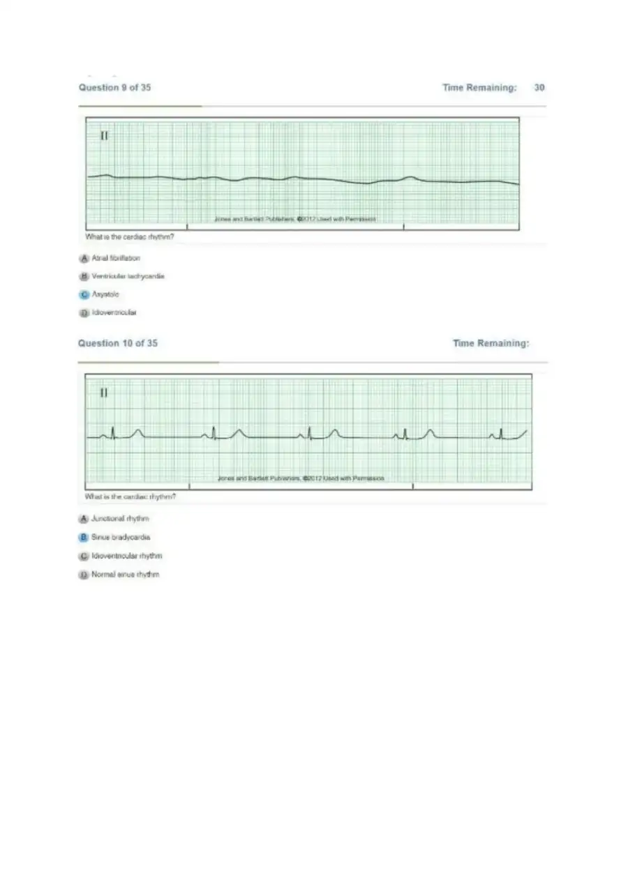 Relias DYSRHYTHMIA BASIC A Exam, page 6